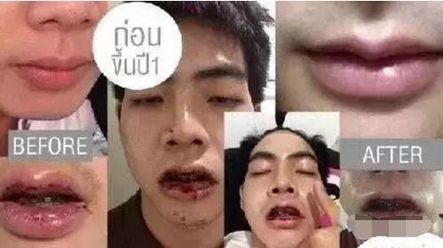 整容男网红吃瓜事件图片,揭秘网络红人背后的真相  第2张