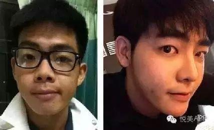 整容男网红吃瓜事件图片,揭秘网络红人背后的真相  第3张